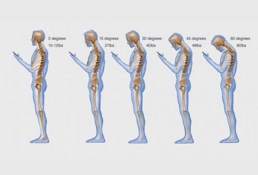 Is your smartphone a pain in the neck?