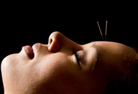 Acupuncture for Anxiety – Stick a Needle in it